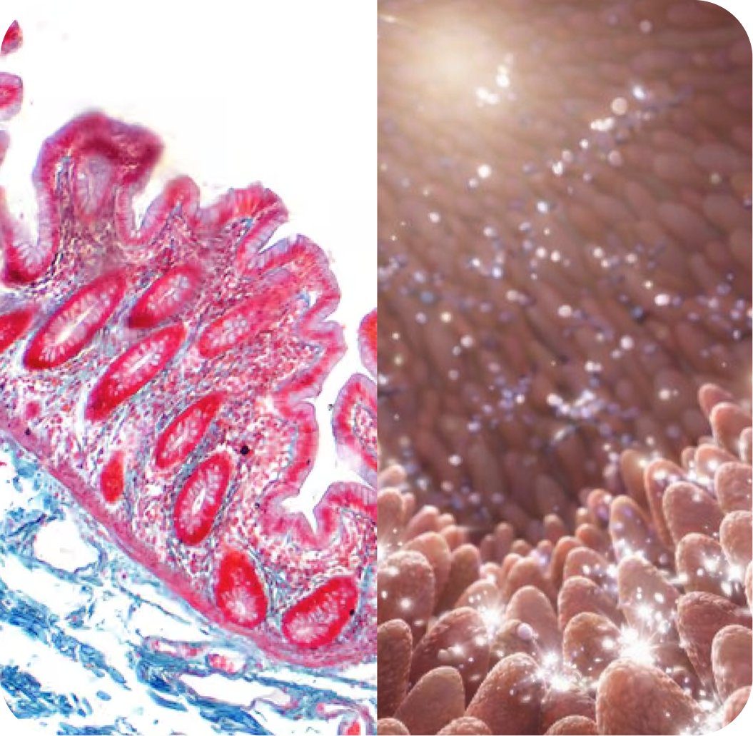 Gut barrier
